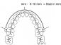 Preview: Arco di distalizzazione molare, misura 1 (80 mm)