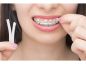 Preview: Cera ortodontica,  Mix / assortita