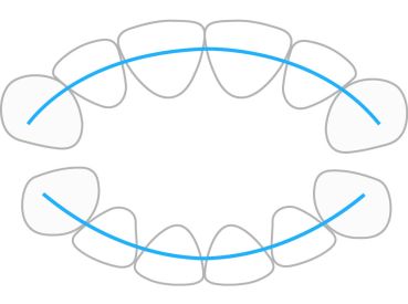 ProTain™ retainer digitale, mascella superiore & inferiore