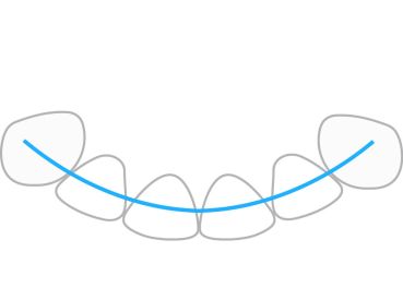 ProTain™ retainer digitale, mascella inferiore