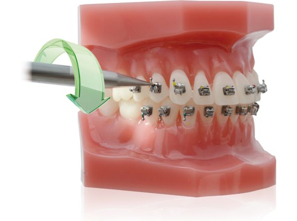 ProSlide™ passive, Strumento